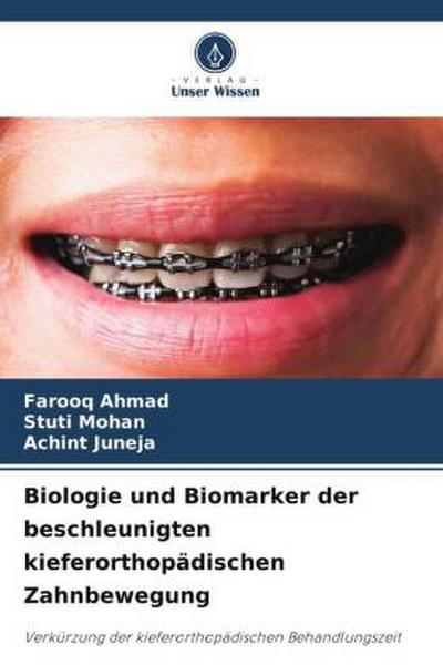 Biologie und Biomarker der beschleunigten kieferorthopädischen Zahnbewegung