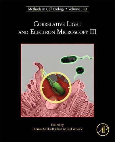 Correlative Light and Electron Microscopy III