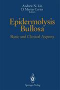 Epidermolysis Bullosa
