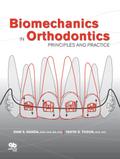 Biomechanics in Orthodontics