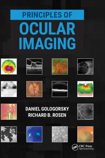 Principles of Ocular Imaging