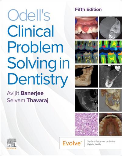 Odell’s Clinical Problem Solving in Dentistry
