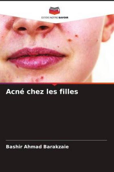 Acné chez les filles