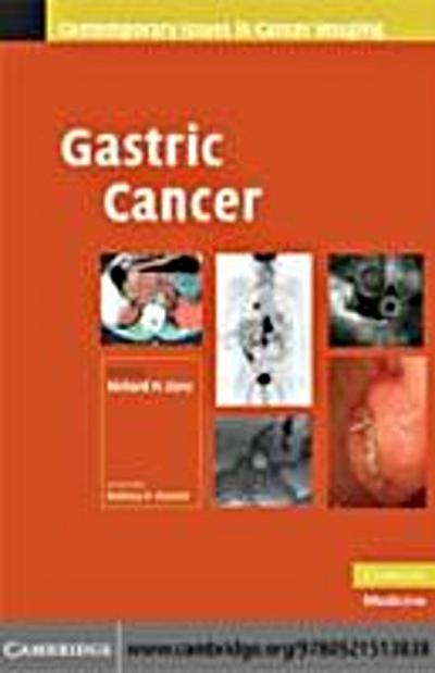Gastric Cancer