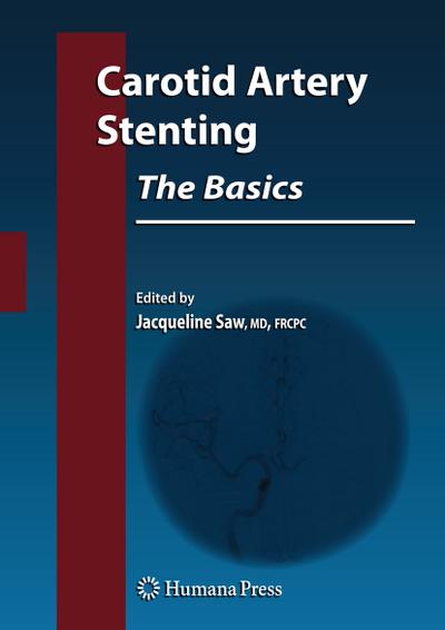 Carotid Artery Stenting