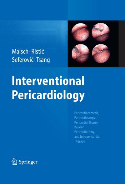 Interventional Pericardiology