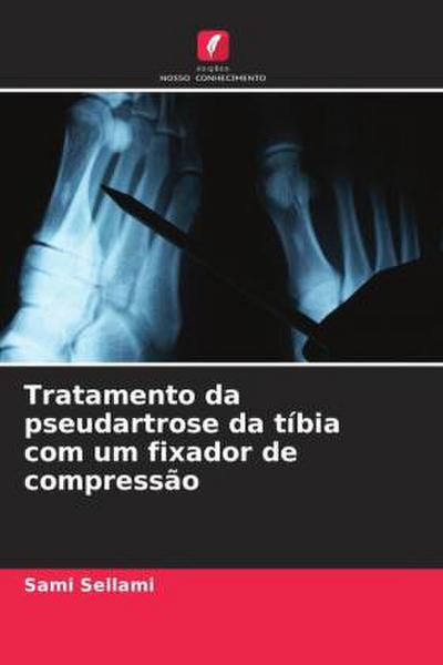 Tratamento da pseudartrose da tíbia com um fixador de compressão