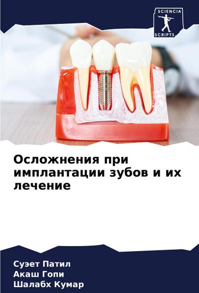Oslozhneniq pri implantacii zubow i ih lechenie