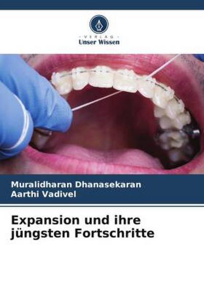 Expansion und ihre jüngsten Fortschritte
