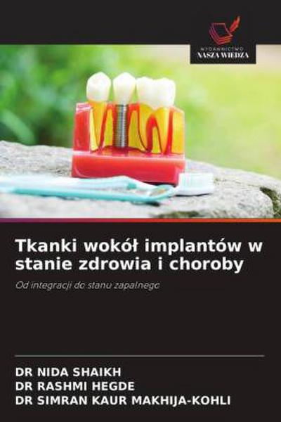 Tkanki wokó¿ implantów w stanie zdrowia i choroby