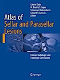 Atlas of Sellar and Parasellar Lesions
