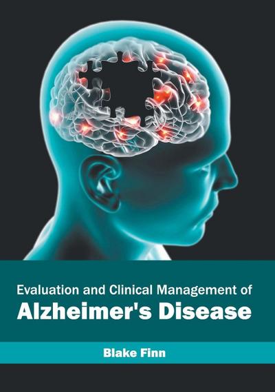 Evaluation and Clinical Management of Alzheimer’s Disease