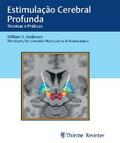 Estimulação Cerebral Profunda