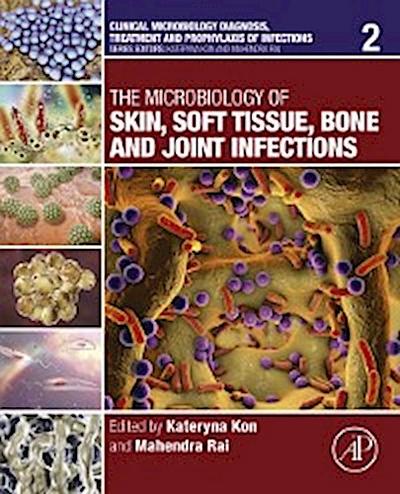 Microbiology of Skin, Soft Tissue, Bone and Joint Infections