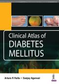 Clinical Atlas of Diabetes Mellitus