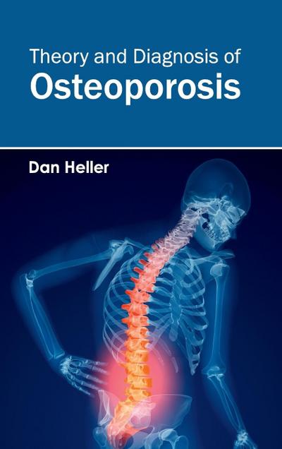 Theory and Diagnosis of Osteoporosis