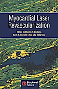 Myocardial Laser Revascularization