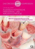 Plastisch-Ästhetische Parodontal- und Implantatchirurgie / Plastisch-Ästhetische Parodontal- und Implantatchirurgie