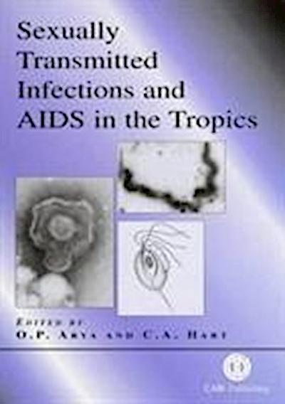 Sexually Transmitted Infections and AIDS in the Tropics