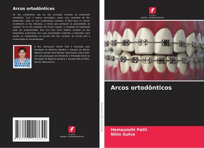 Arcos ortodônticos