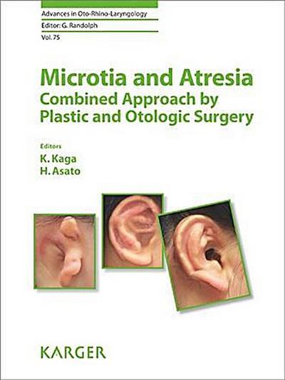 Microtia and Atresia - Combined Approach by Plastic and Otologic Surgery