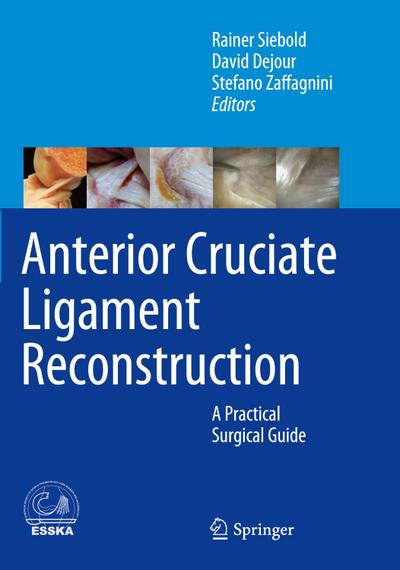 Anterior Cruciate Ligament Reconstruction