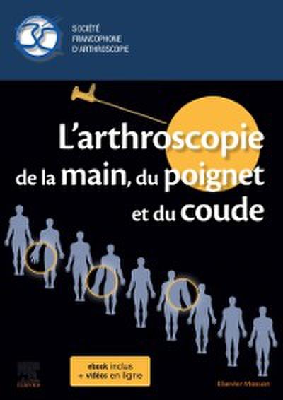 L’arthroscopie de la main, du poignet et du coude