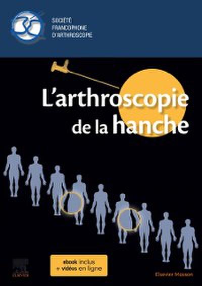 L’arthroscopie de la hanche