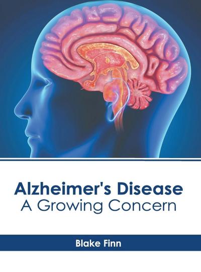 Alzheimer’s Disease