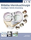 Bildatlas Meniskuschirurgie