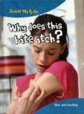 Why does this Bite Itch?