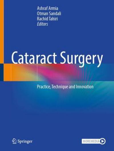 Cataract Surgery