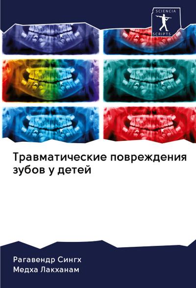 Trawmaticheskie powrezhdeniq zubow u detej