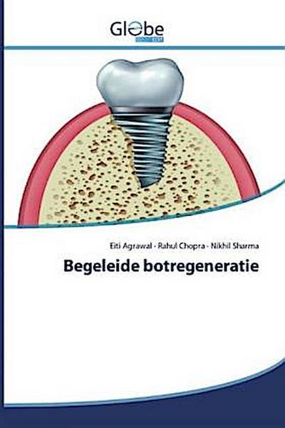 Begeleide botregeneratie