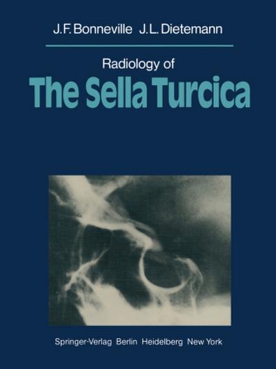 Radiology of The Sella Turcica