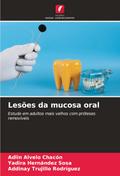 Lesões da mucosa oral