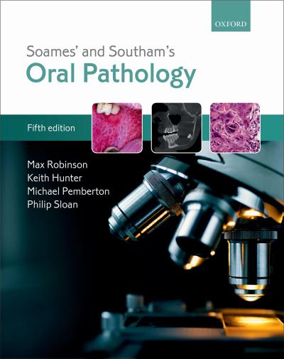 Soames’ & Southam’s Oral Pathology