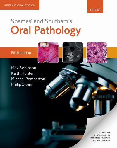 Soames’ & Southam’s Oral Pathology