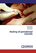 Healing of periodontal wounds