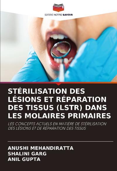 STÉRILISATION DES LÉSIONS ET RÉPARATION DES TISSUS (LSTR) DANS LES MOLAIRES PRIMAIRES