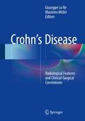 Crohn’s Disease