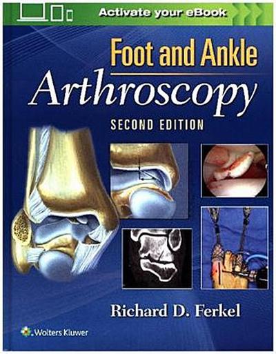 Foot & Ankle Arthroscopy