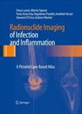 Radionuclide Imaging of Infection and Inflammation