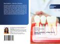 Basal Implants - a New Era in Dentistry