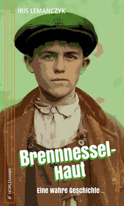 Lemanczyk,Brennnessel-Haut