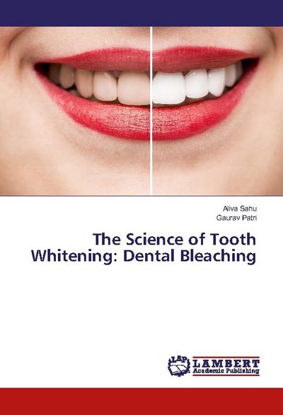 The Science of Tooth Whitening: Dental Bleaching