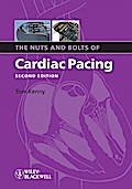 The Nuts and Bolts of Cardiac Pacing