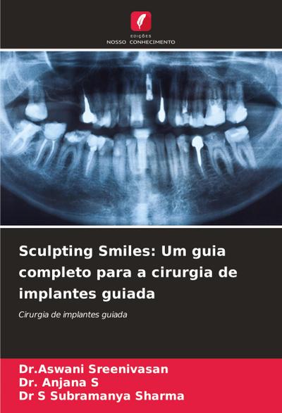Sculpting Smiles: Um guia completo para a cirurgia de implantes guiada