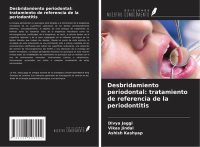 Desbridamiento periodontal: tratamiento de referencia de la periodontitis