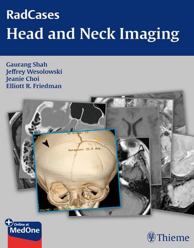 RadCases Head and Neck Imaging